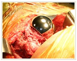 Slider image (10) Dr. A. K. Venkatachalam MJRC Clinic